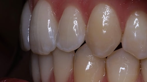 Dentalfoto: Detailaufnahme für das Labor