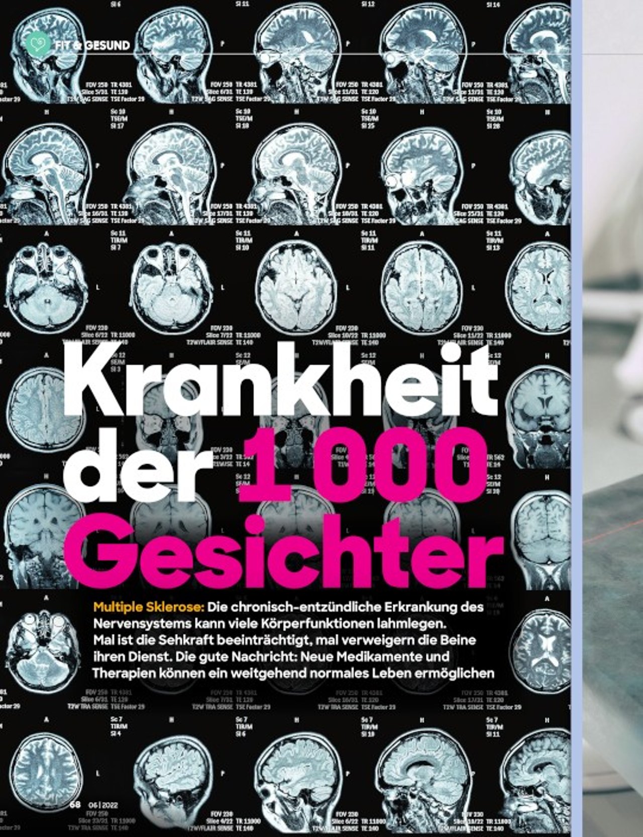 Krankheit der 1.000 Gesichter.