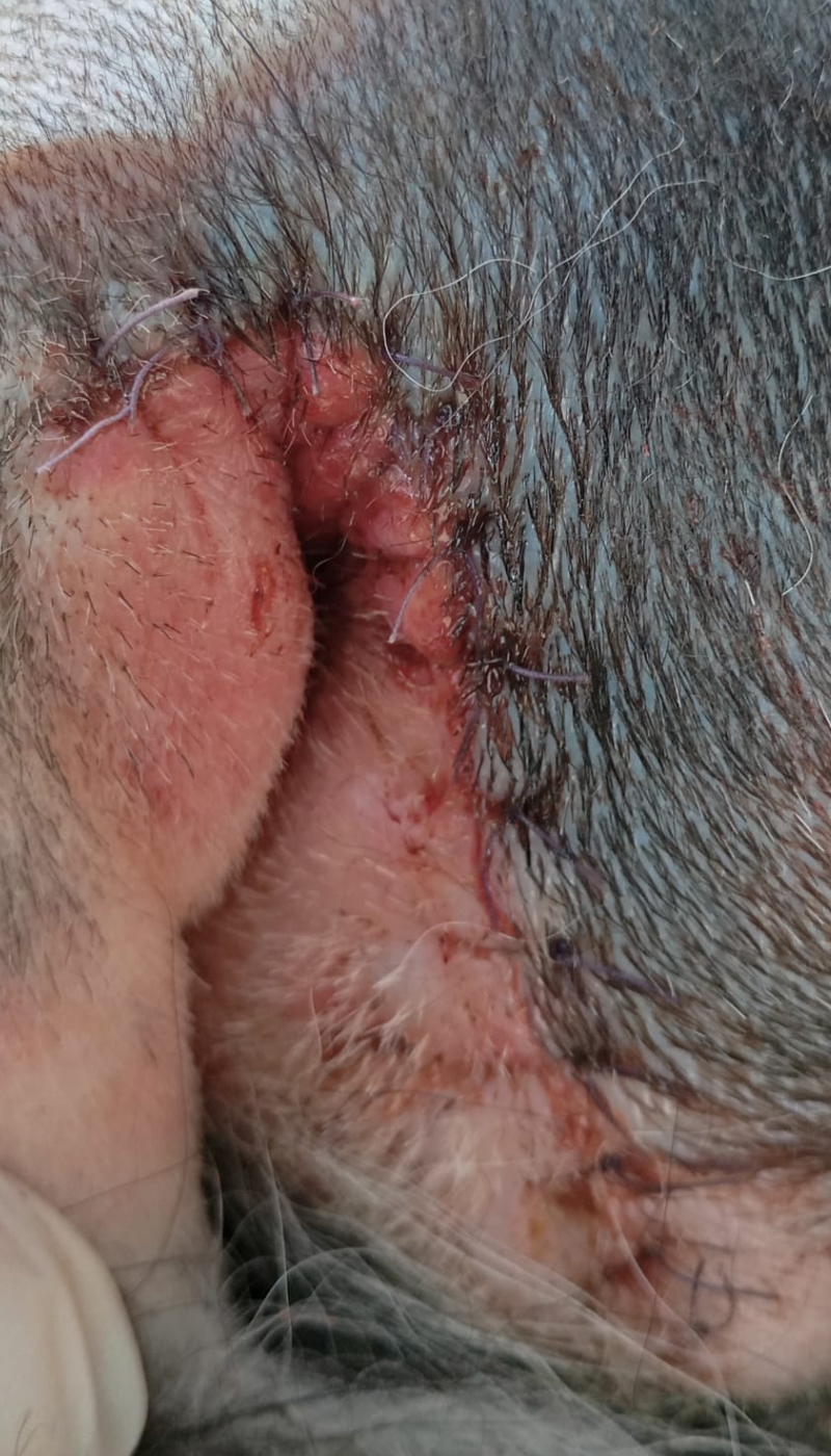 Fallbeispiel entzündung nach Entfernung anal carzinom Situation vor AMAMUS Vet coldPlasma Behandlung