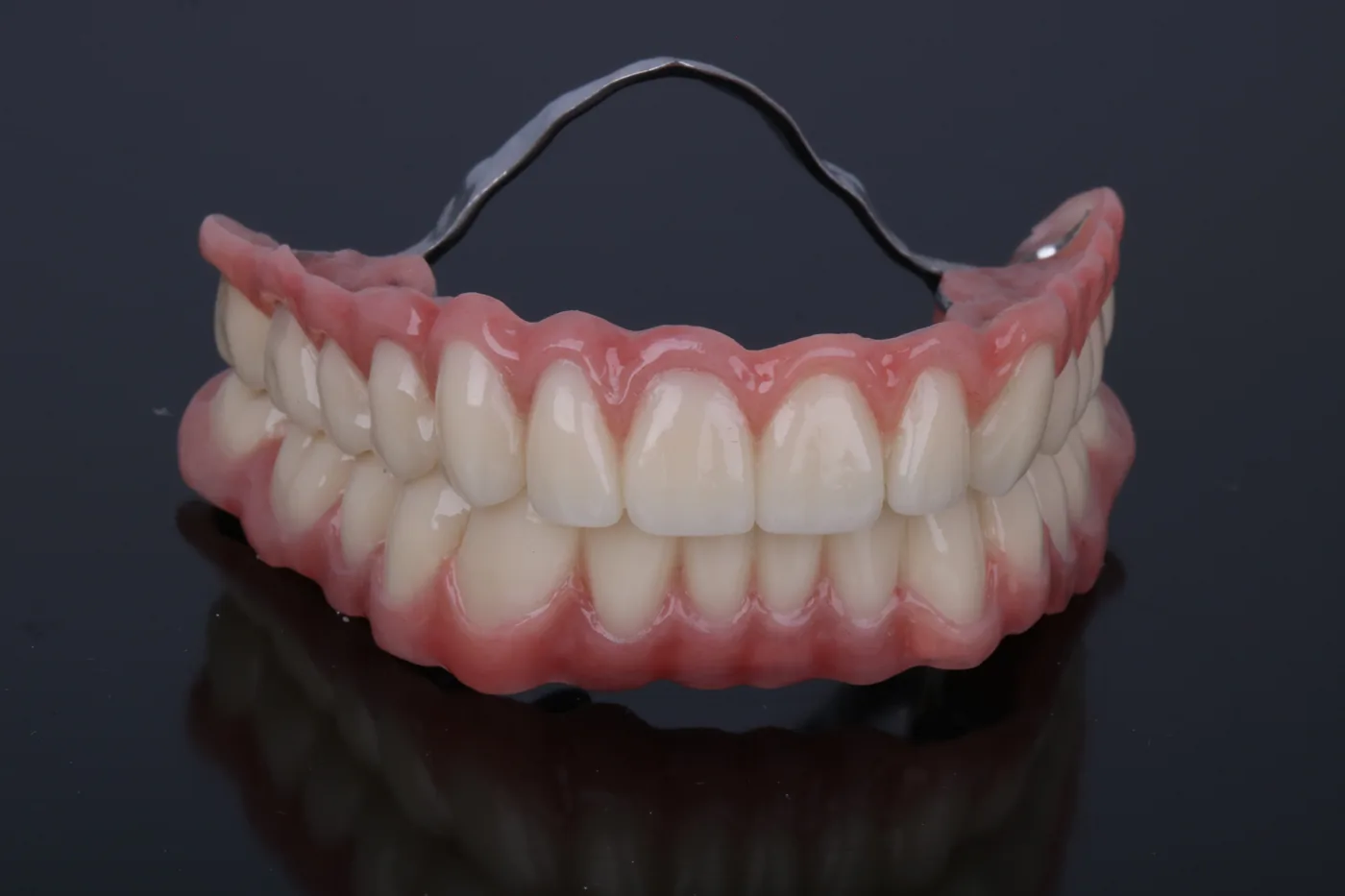 Teleskoparbeit für Ober- und Unterkiefer aus NEM, passgenau gefräst, von ADU-Dental