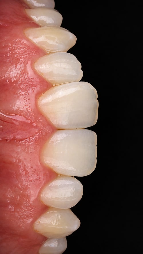 Dentalfoto: Frontzähne seitlich vor schwarzem Hintergrund
