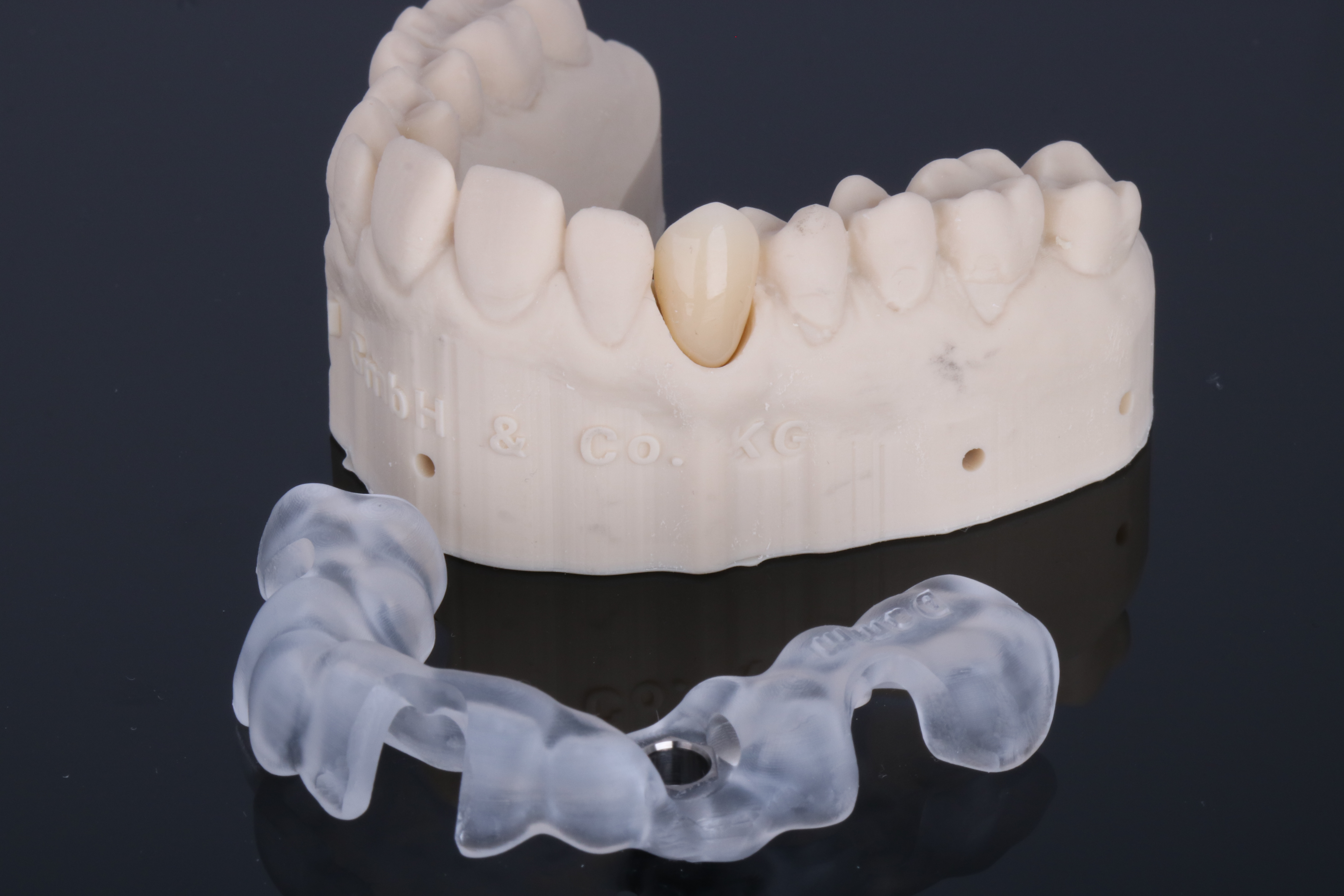Klassische Bohrschablone, abgestützt auf dem Restzahnbestand, dahinter ein 3D-gedrucktes Modell mit der verschraubten Krone, von ADU-Dental
