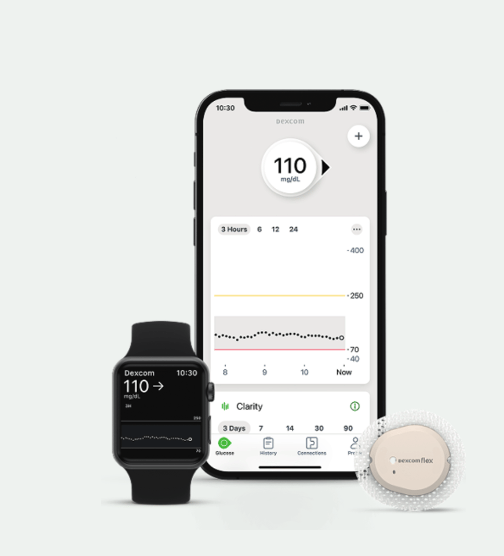 Smartphone mit Dexcom App, Smartwatch und Dexcom Flex Sensor