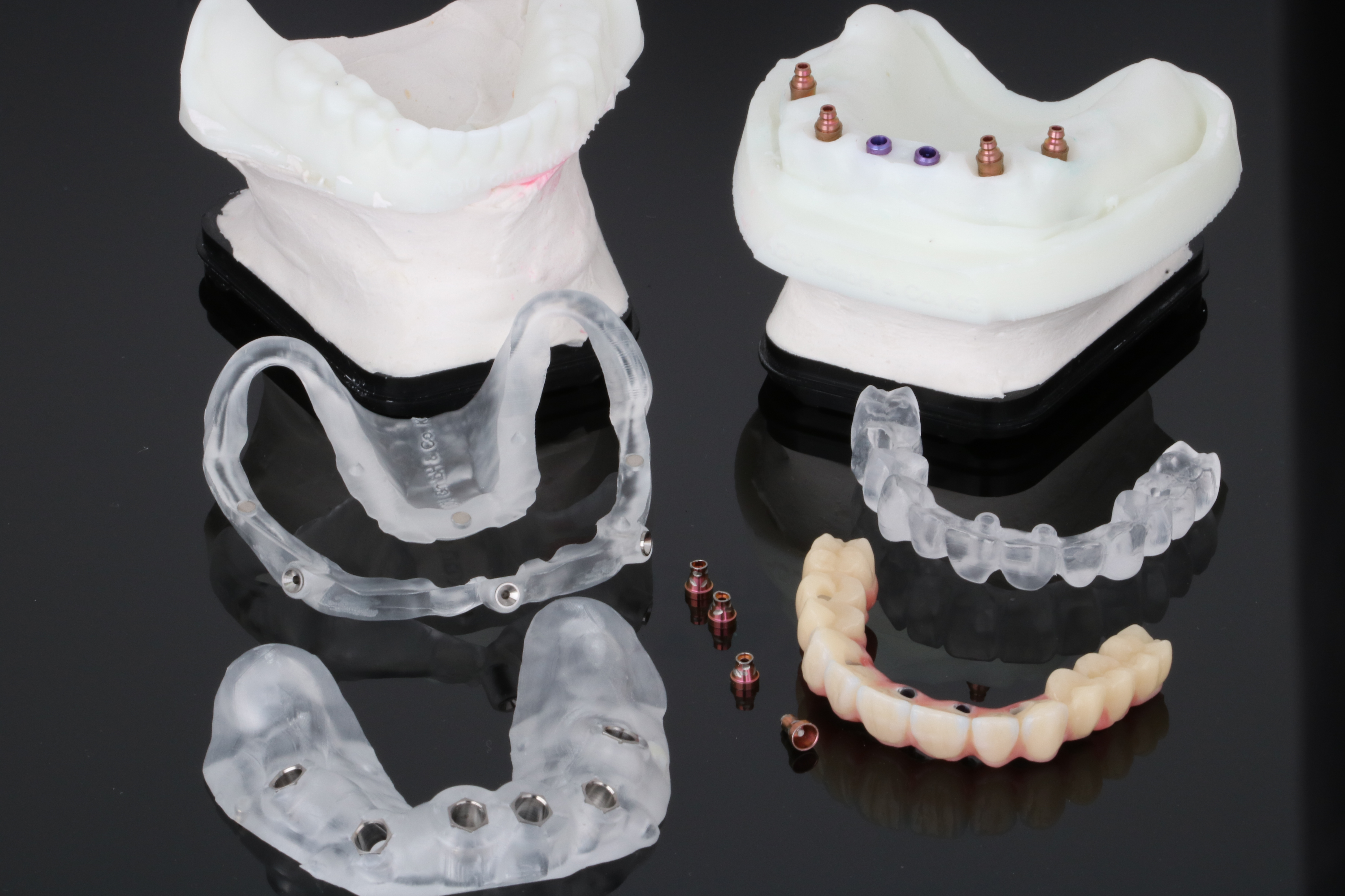 Geteilte Bohrschablone mit Basisguide und aufgesetzter Schablone von ADU-Dental