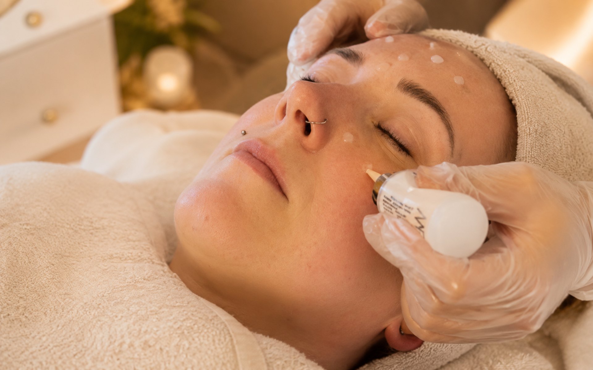 Frau mit natürlich ebenmäßig wirkendem Teint vor einem BB Glow Facial bei SWON in Pforzheim