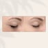 Professional laser aesthetics Glendale Arizona