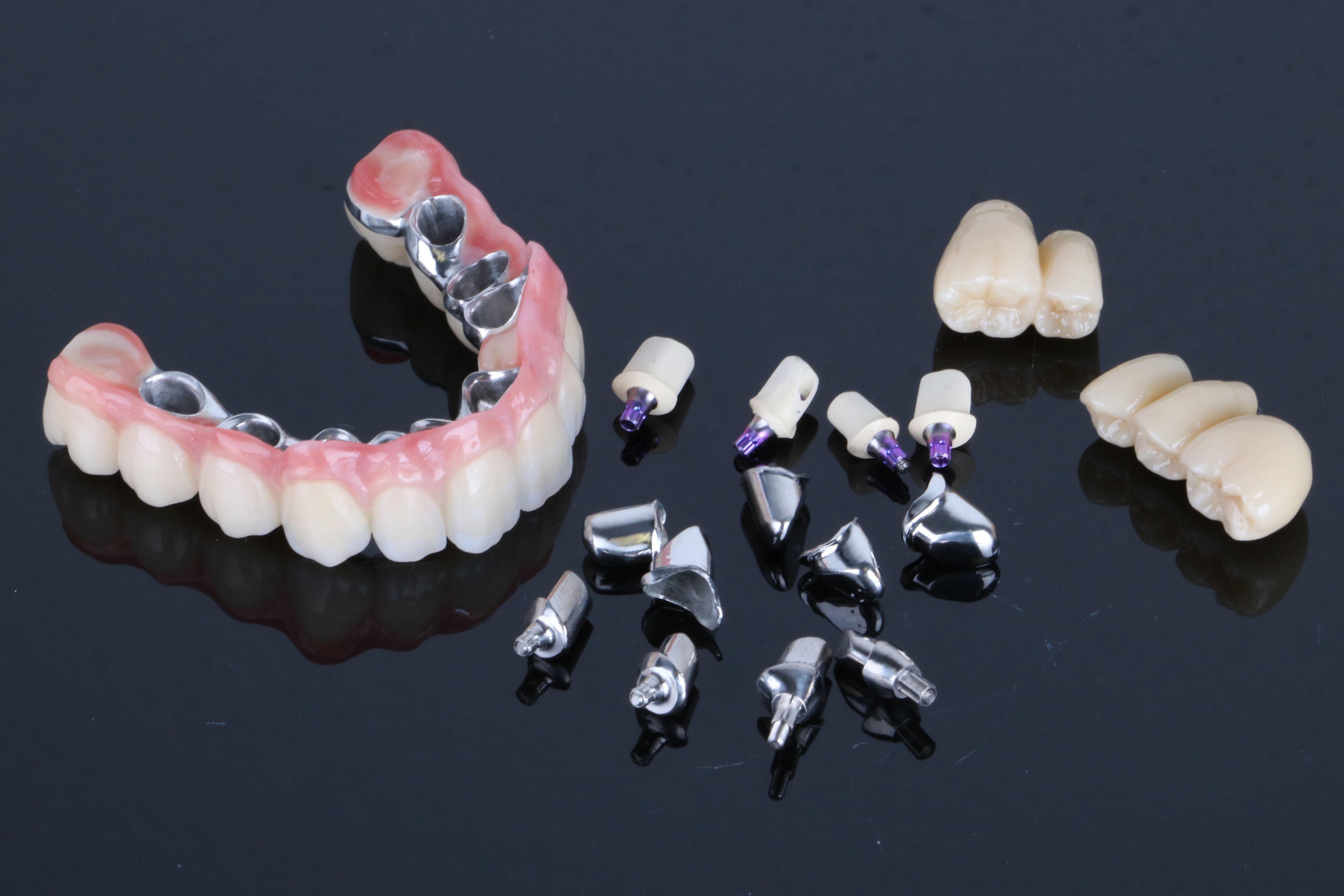 Titan-Teleskopversorgung mit Primärteleskopen auf individuellen Titan-Abutments von ADU-Dental