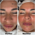 Gesicht einer Frau mit geschlossenen Augen, Vorher-Nachher-Vergleich, Text: "BEAUTYLINE", "Vorher", "Nachher".
