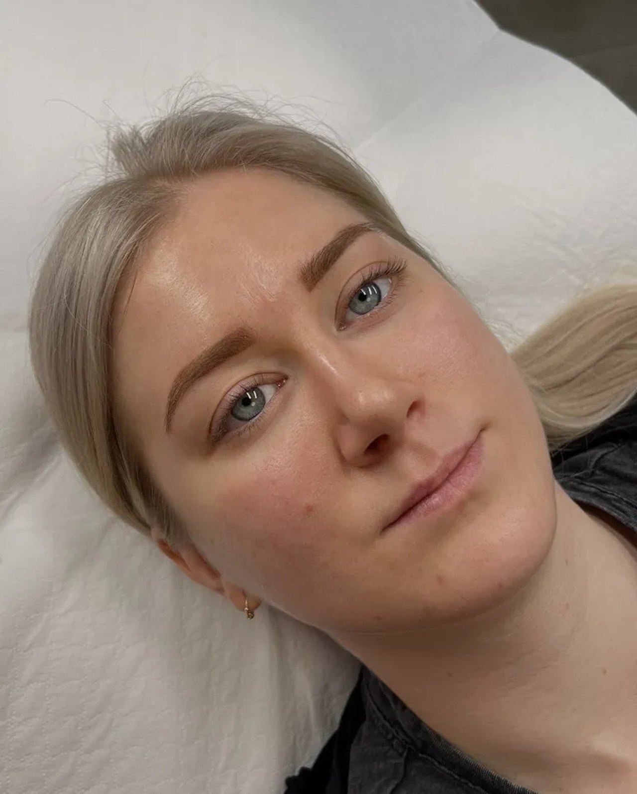 Dieselbe Kundin nach der Behandlung
