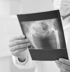 Muscle cramping from sciatica therapy Baltimore Maryland