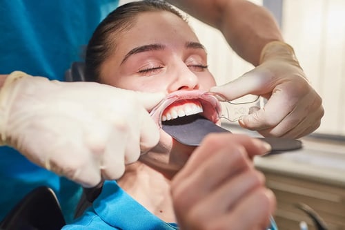 dental-photo-systeme_PIC_44