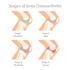 Arthritis Treatment in Columbia