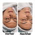 Gesicht einer Person mit geschlossenen Augen, links "Vorher" und rechts "Nachher" beschriftet.