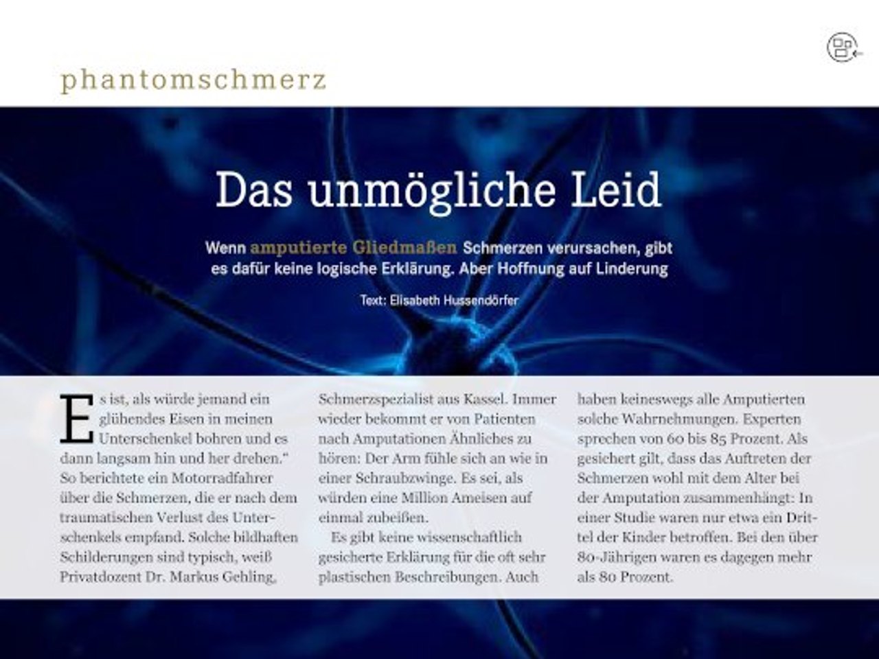 Phantomschmerz: Das unmögliche Leid.