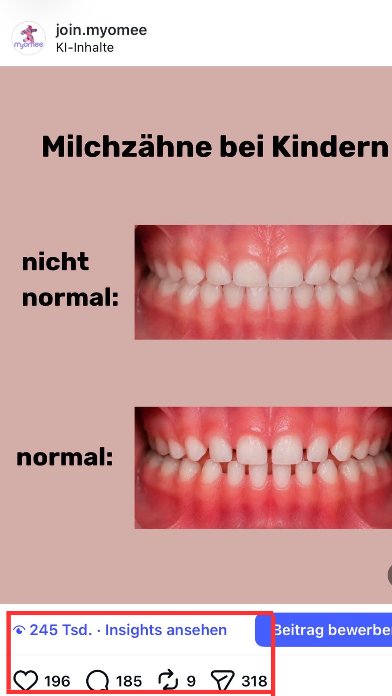 Milchzähne bei Kindern