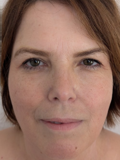 Marion vorher