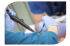Hände in blauen Handschuhen halten ein Endoskop und führen es in einen Patientenmund ein.