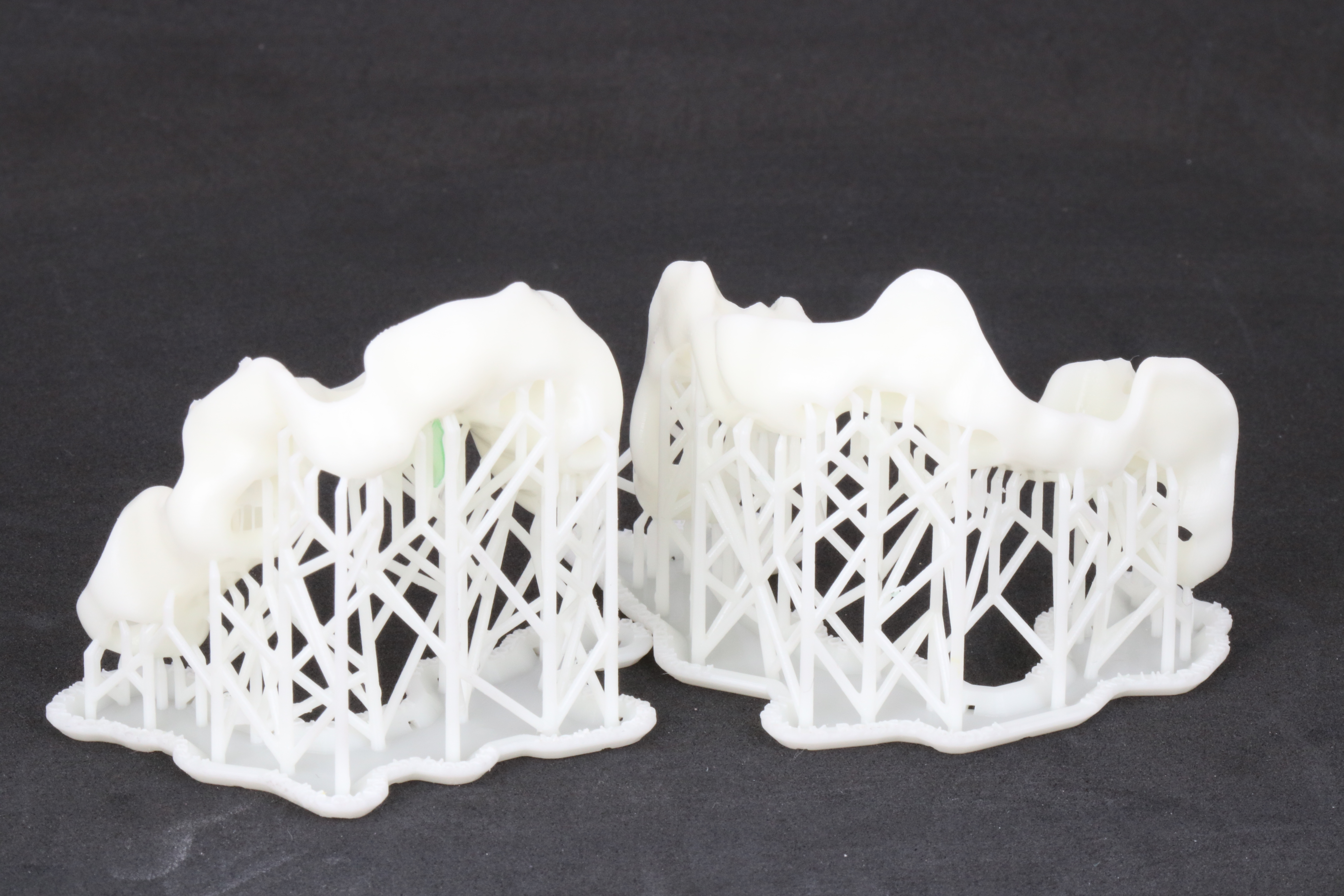 3D-gedruckte Bohrschablonen von ADU-Dental