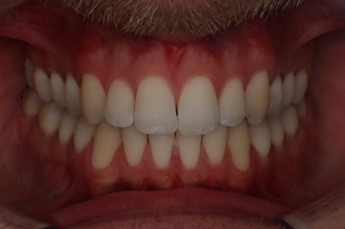 Dentalfoto: Fotostatus frontal