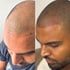before and after