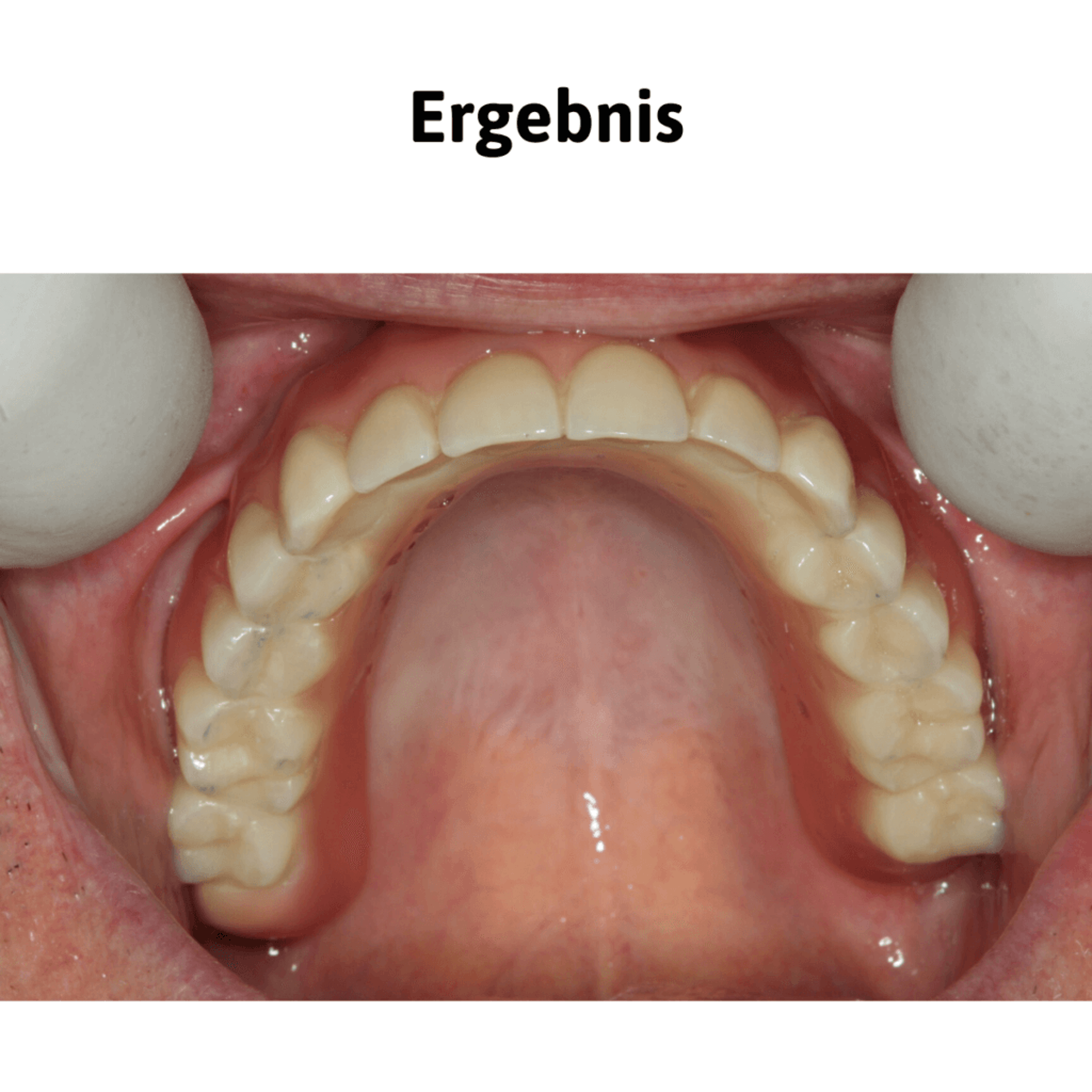 Ergebnis