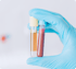 Prp knee injection Fort Myers FL