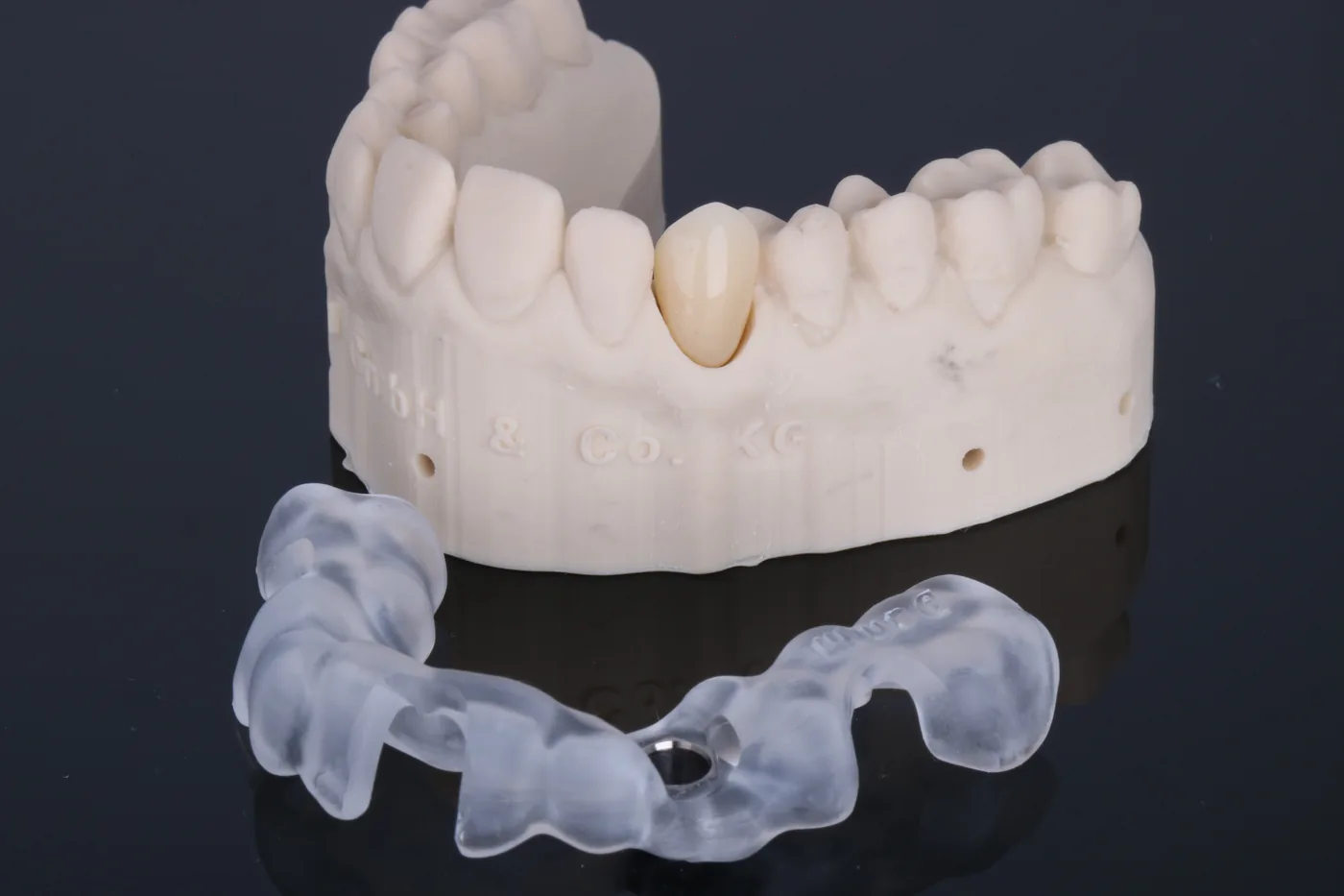 Klassische Bohrschablone, abgestützt auf dem Restzahnbestand, dahinter ein 3D-gedrucktes Modell mit der verschraubten Krone, von ADU-Dental