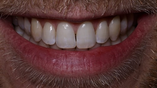Dentalfoto: Lächeln extraoral