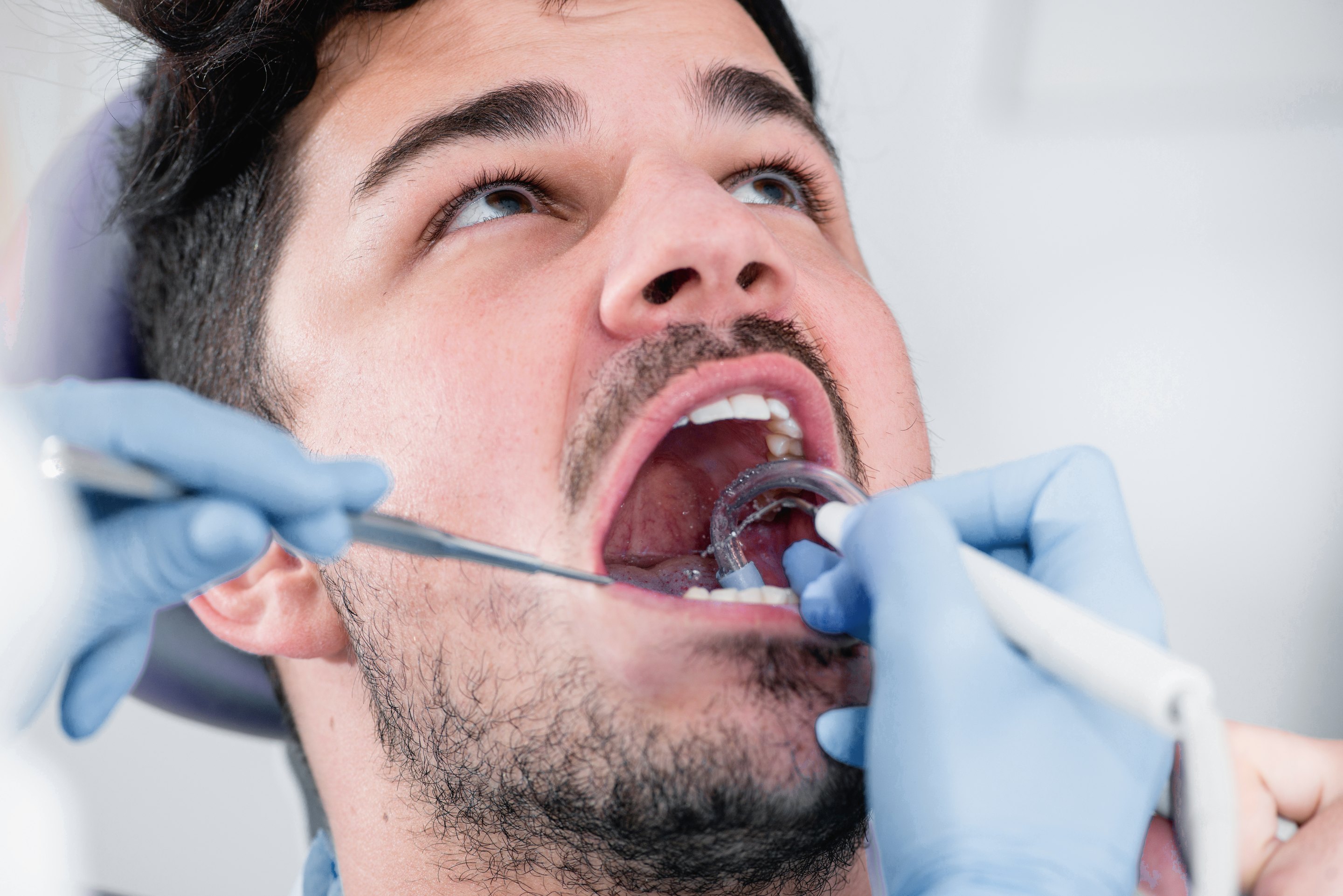 Wann sollten Sie zum Zahnarzt gehen?