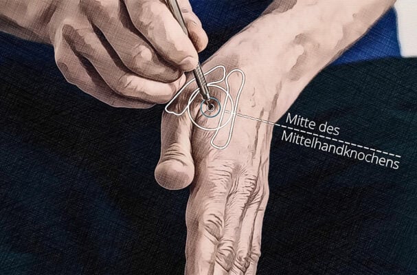 Di 4 (Hegu) Akupressurpunkt Position