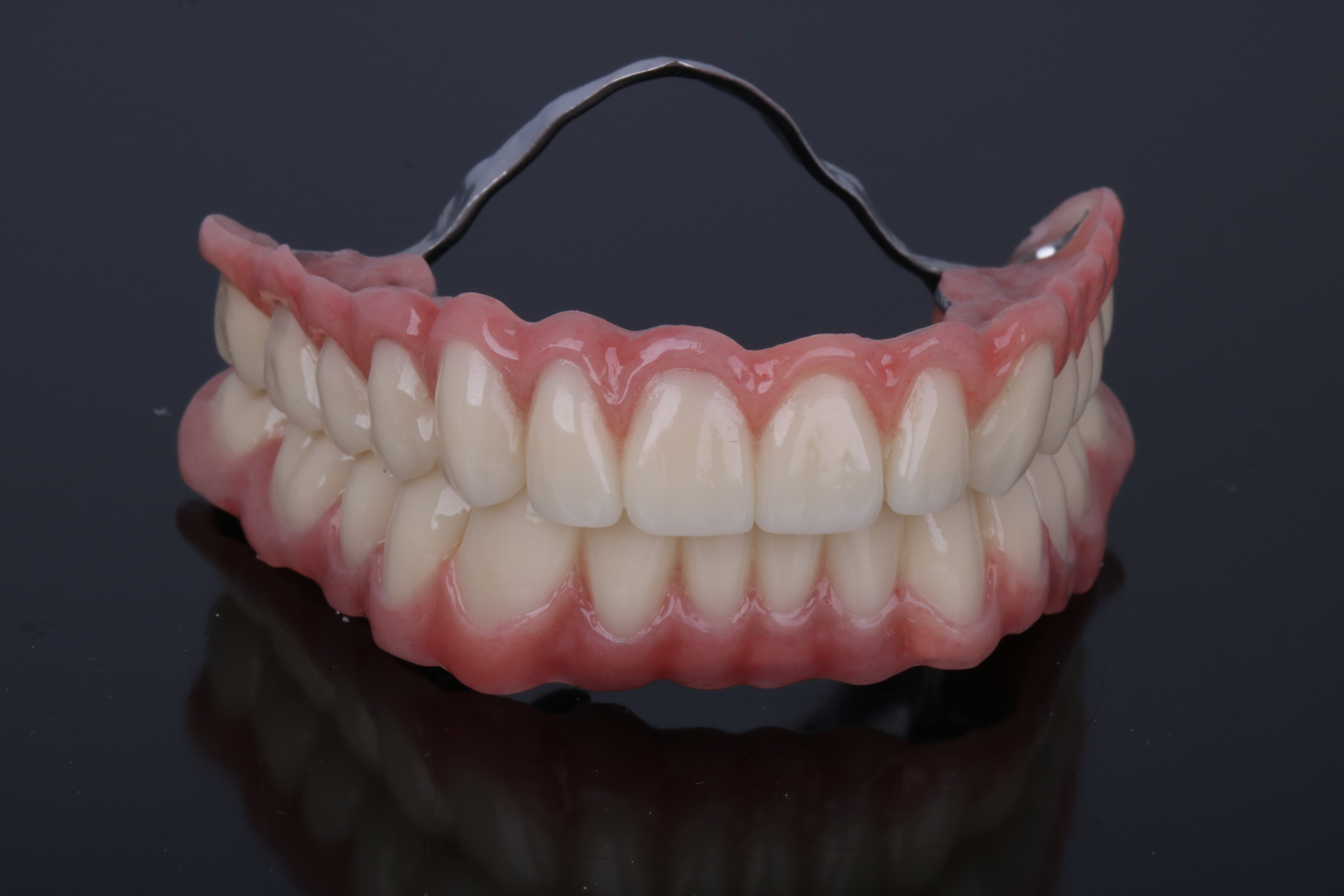 Teleskoparbeit für Ober- und Unterkiefer aus NEM, passgenau gefräst, von ADU-Dental