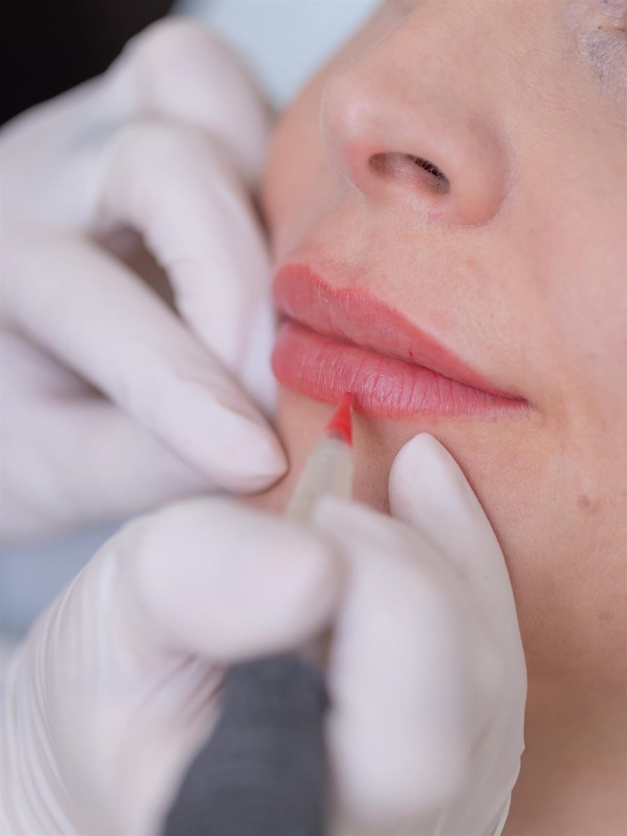 Originalaufnahme aus Sara Pavos Praxis zur Lippenpigmentierung