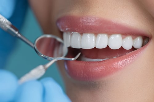 Dentalhygiene
