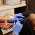 Gloved hands administer a PRP injection into a patient's scalp, with a vial labeled PRP on a medical tray.