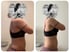 Vorher-Nachher-Bild einer Kundin für das Abnehmcoaching für Frauen mit Schilddrüsenunterfunktion von Marie Kessel