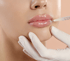 Eine Person erhält eine Lippenunterspritzung mit einer Spritze in die Oberlippe.