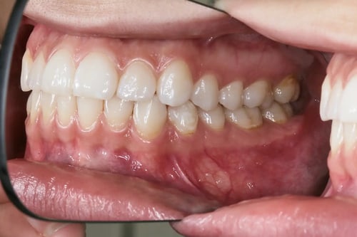 dental-photo-systeme_PIC_65