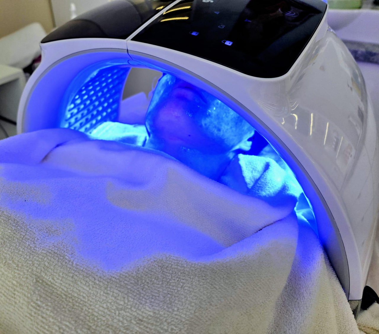 Apparative Gesichtsbehandlung mit blauem Licht zur Unterstützung bei unreiner, zu Akne neigender Haut