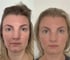 Der Effekt von Facefitness: eine Kundin von Facefitness by Anna Bernwald