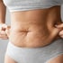Anti-cellulite therapy Tuscaloosa