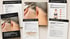 narben-preview.webp