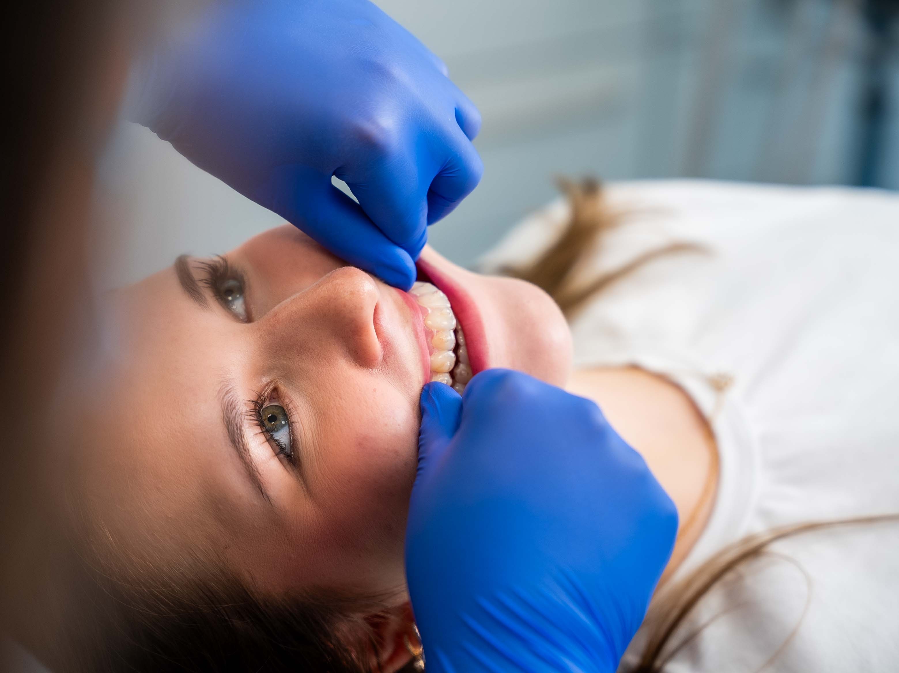 Aligner-Schiene wird eingesetzt