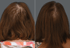 Before & After of face and hair serum treatment results