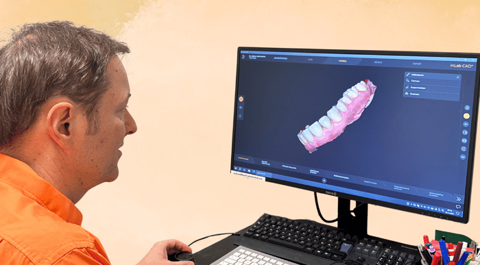 Dr. Simon Müller plant den Zahnersatz digital am 3D-Bildschirm