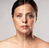 Woman's face before and after rejuvenation