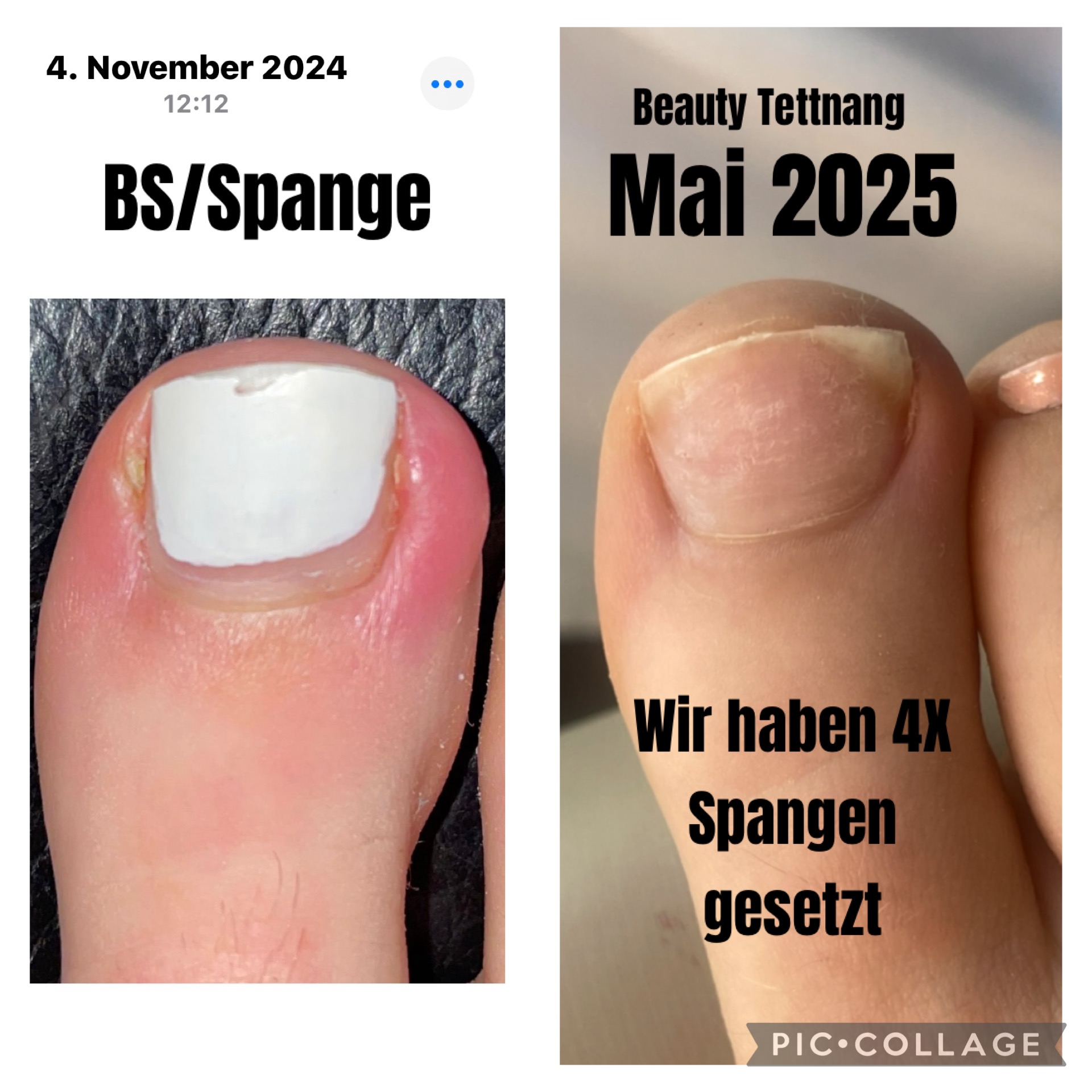 BS Spangen