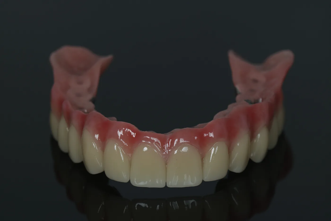 Teleskoparbeit für den Oberkiefer aus Titan-Legierung, gefräst, von ADU-Dental