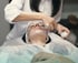 Woman with closed eyes receiving a Vampire Facial, white mask applied by gloved hand