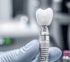 Implantate
