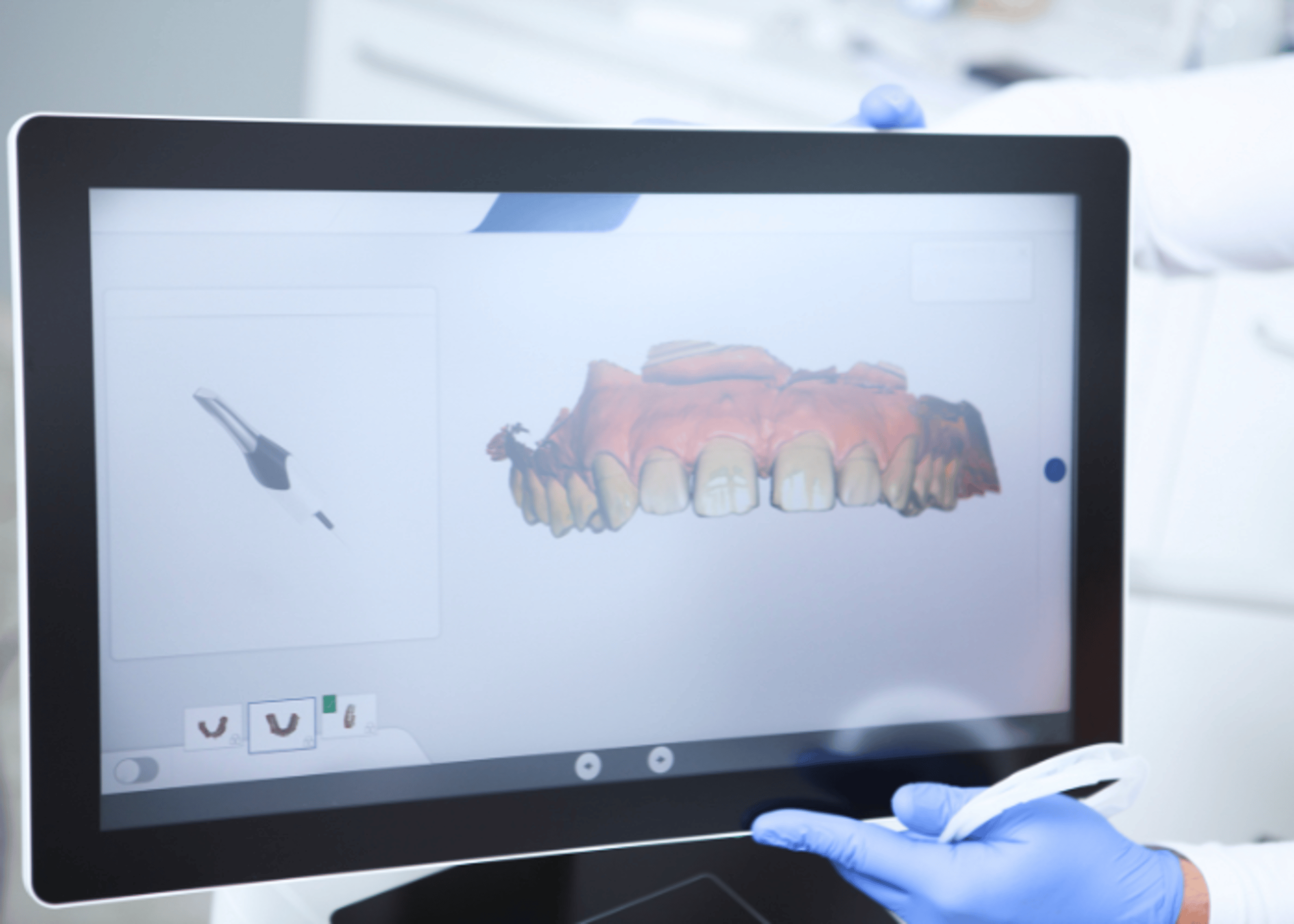 3D-Modell der Zähne auf dem Praxisbildschirm